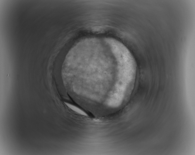 X0000088691249200706281955