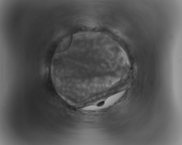 X0000088691302200706281954