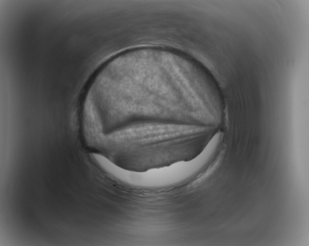 X0000088691501200706281952