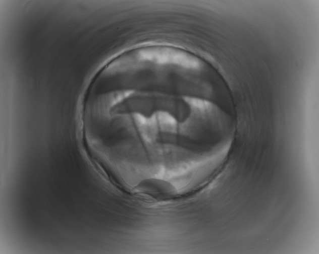 X0000088691522200706281952