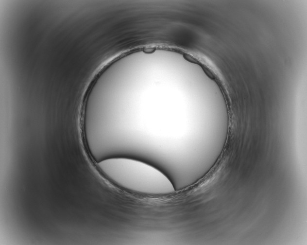 X0000088700847200705311014