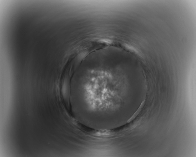X0000088700720200706071540