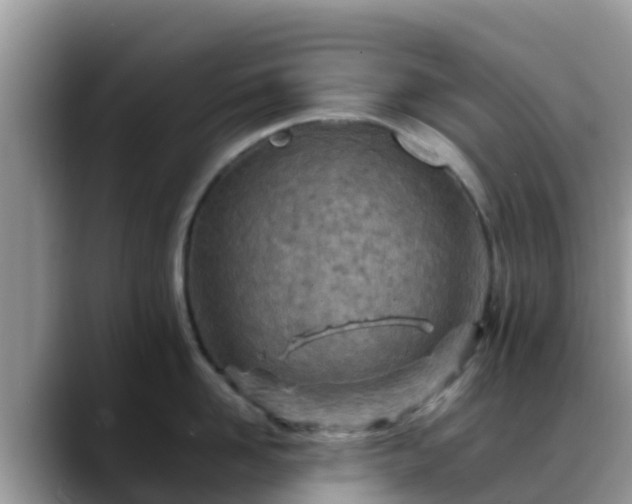X0000088700958200706071537