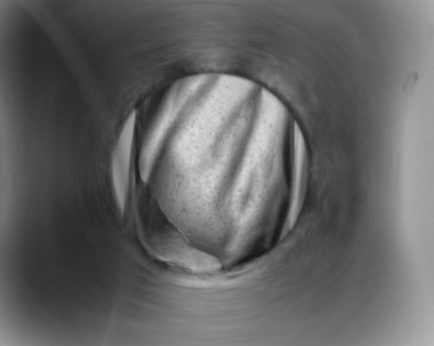 X0000088700017200706141438