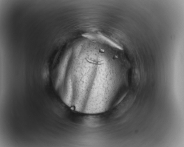 X0000088700320200706141435