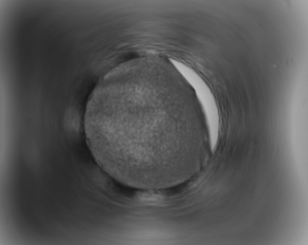 X0000088700331200706141435