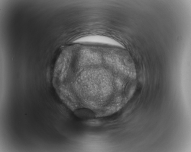 X0000088700519200706141432