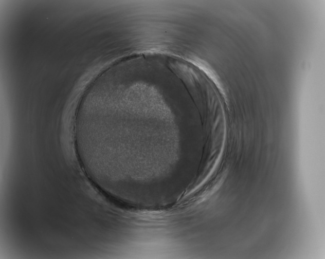 X0000088700577200706141432