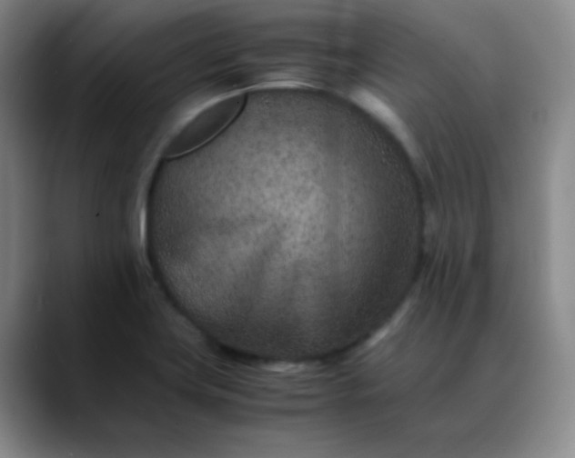 X0000088701419200706141422