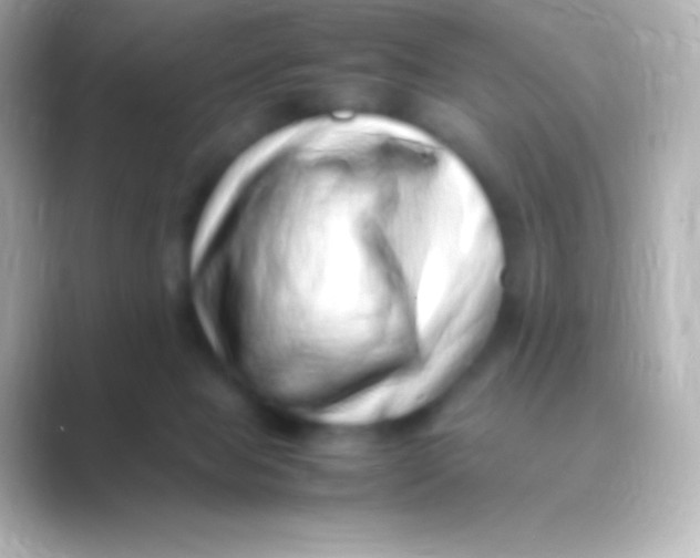 X0000088700077200706211952