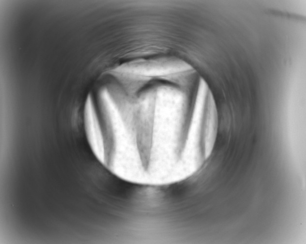 X0000088700140200706211951