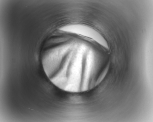 X0000088700258200706211950