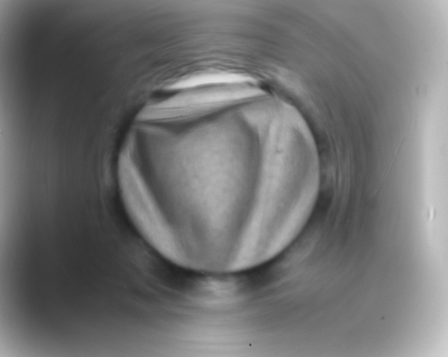 X0000088700317200706211949