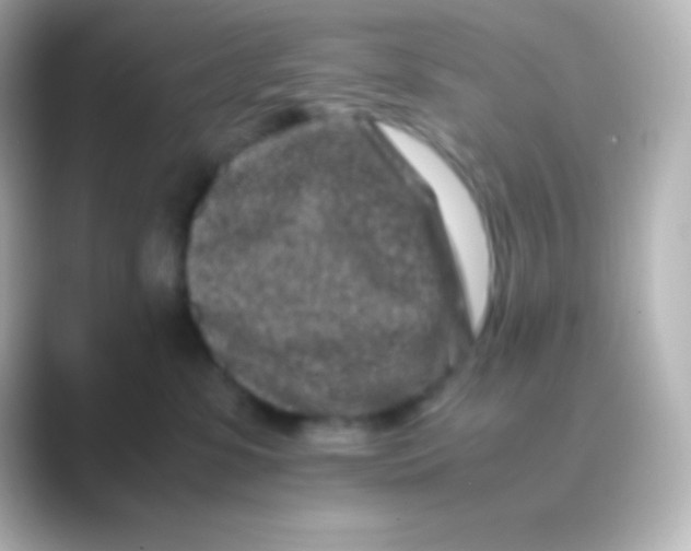 X0000088700331200706211949