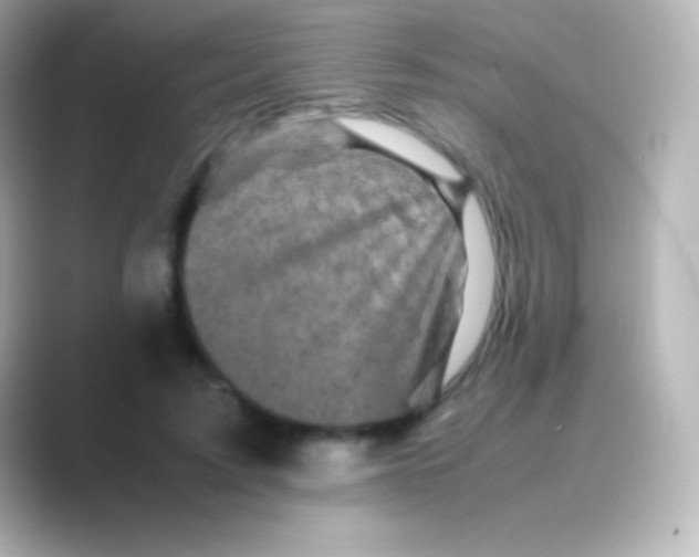 X0000088700595200706211946