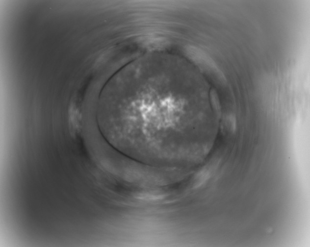 X0000088701010200706211941