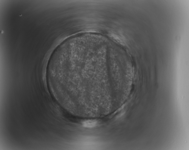 X0000088700099200706282031