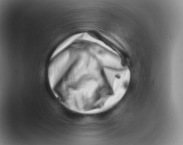 X0000088700111200706282031