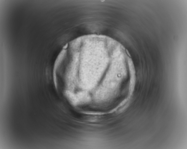 X0000088700182200706282030