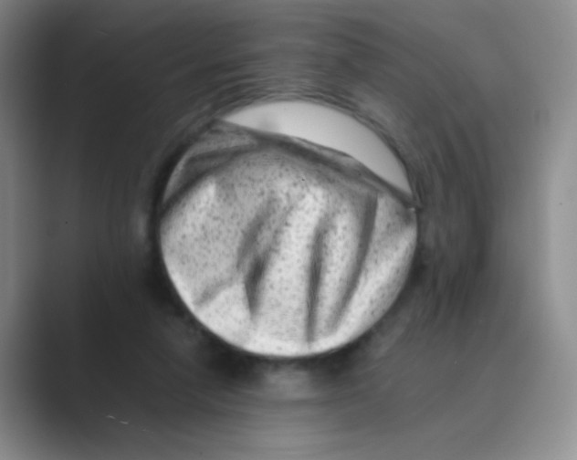 X0000088700258200706282029