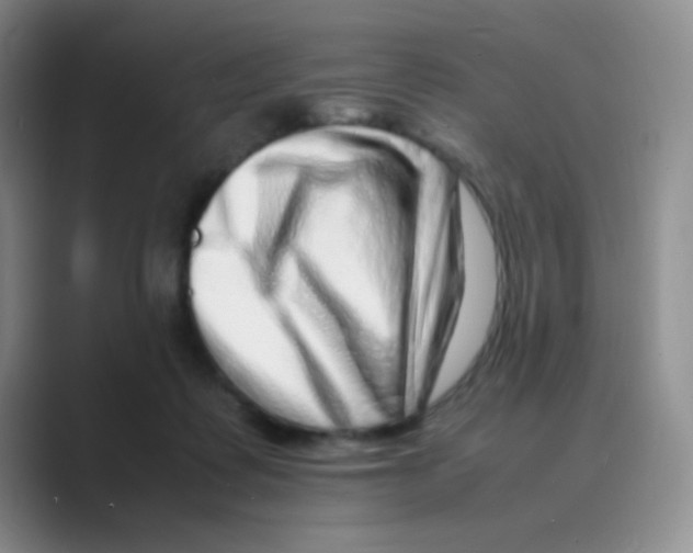 X0000088700315200706282028