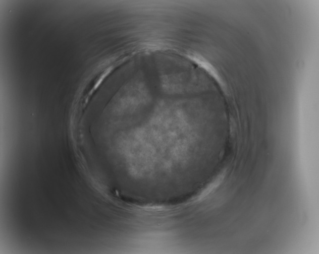 X0000088700581200706282025