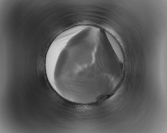 X0000088700945200706282020