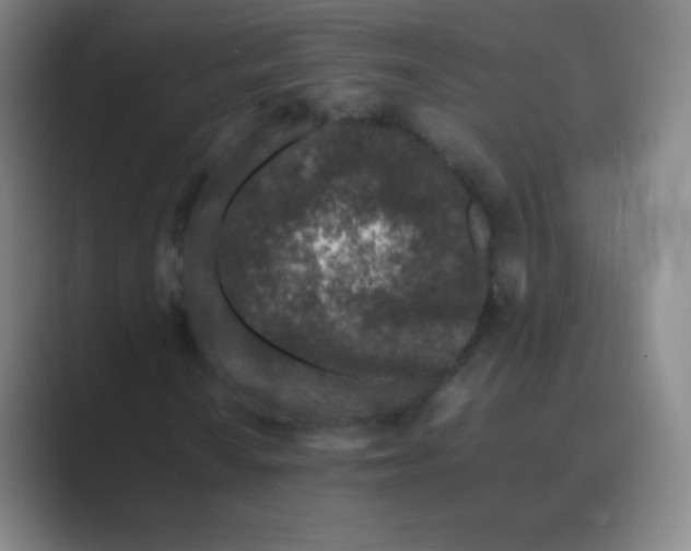 X0000088701010200706282018