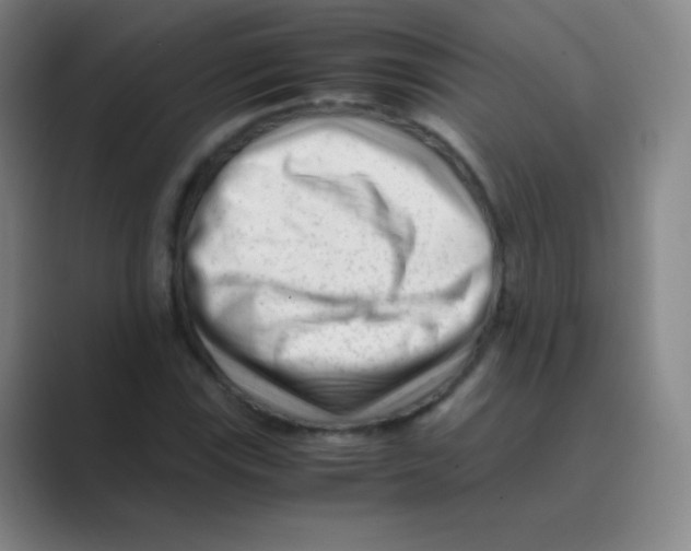 X0000088701115200706282017