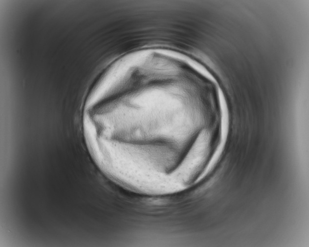 X0000088701145200706282018