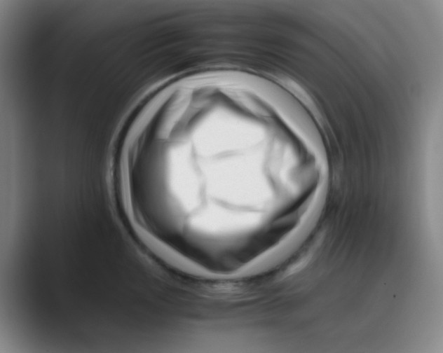 X0000088701149200706282018