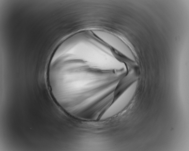 X0000088701197200706282016