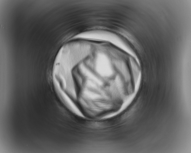 X0000088701241200706282016