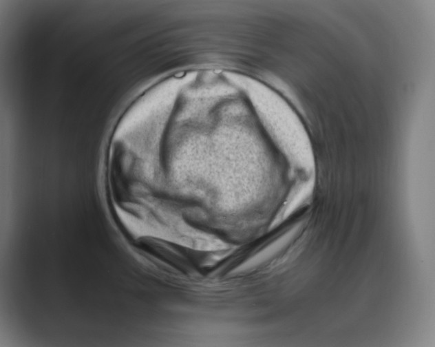 X0000088701387200706282014