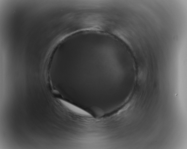 X0000088711455200706141440