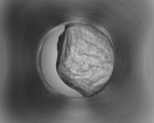 X0000088711152200706282038