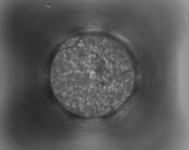 X0000088711255200706282036