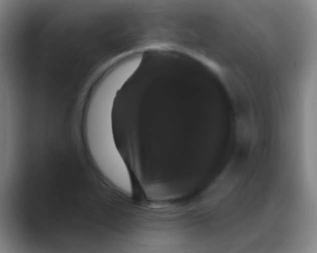 X0000088711319200706282035