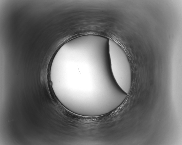 X0000088720147200705311103