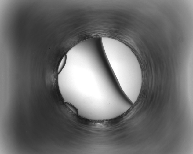 X0000088720285200705311103