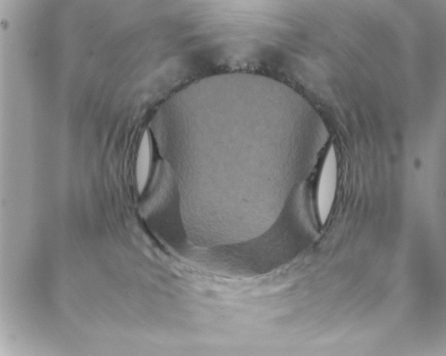 X0000088720039200706141624