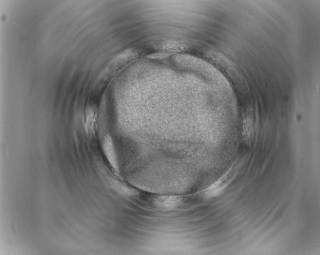 X0000088720142200706141622