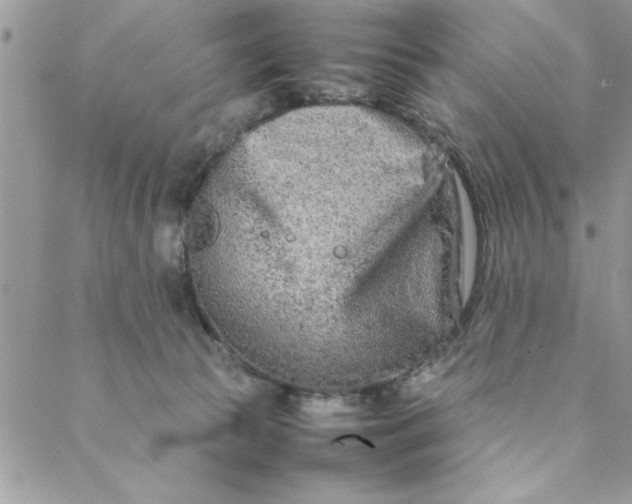 X0000088720177200706141622