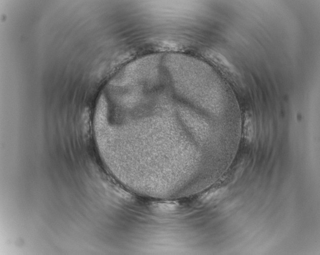 X0000088720318200706141619