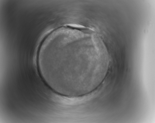 X0000088720006200706212029