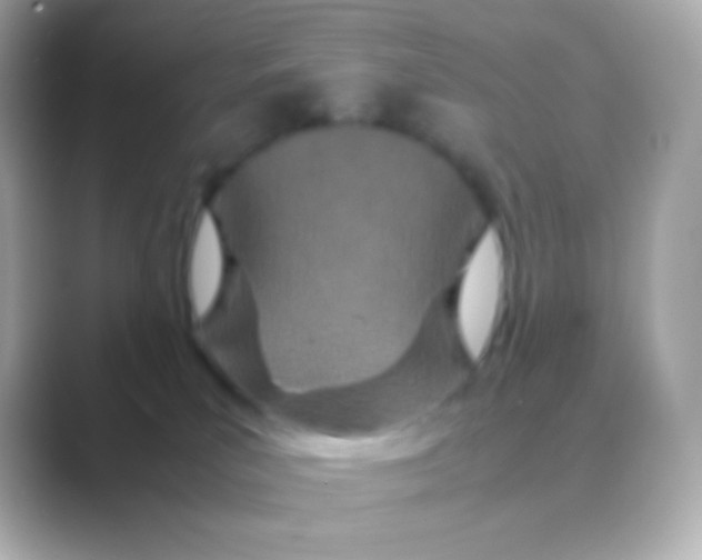 X0000088720039200706212028