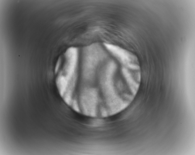 X0000088720085200706212028