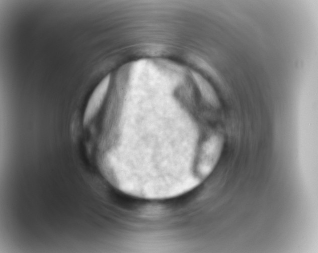 X0000088720119200706212027