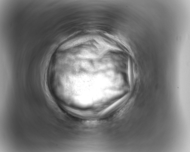 X0000088720145200706212027