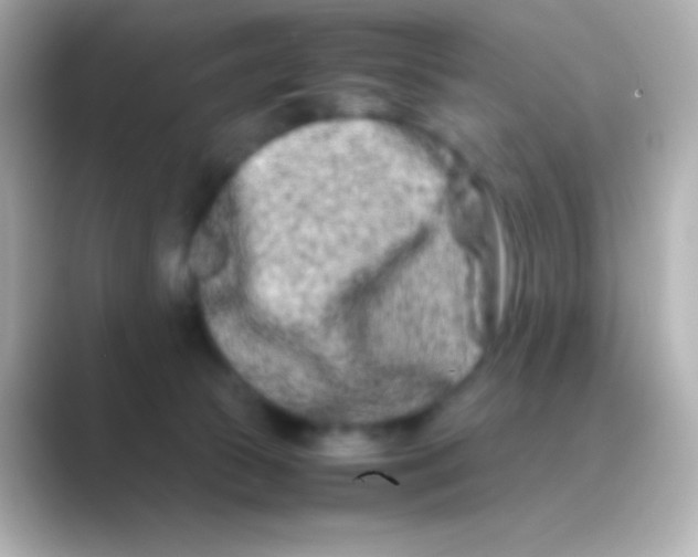 X0000088720177200706212027